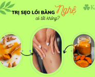 Trị sẹo lồi bằng nghệ có tốt không? 