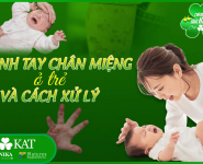 Bệnh tay chân miệng ở trẻ và cách xử lý