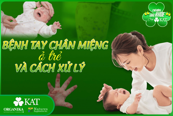 Bệnh tay chân miệng ở trẻ và cách xử lý