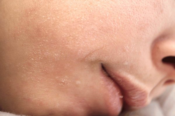 Tác hại của việc thiếu ngủ đối với làn da