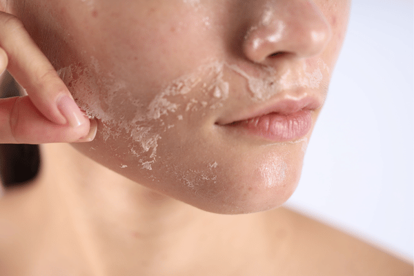 Làn da thường xuyên xuất hiện tình trạng khô và bong tróc